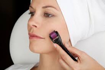 Trị sẹo lõm lâu năm ở mặt nhanh nhất - Sức khỏe & Môi trường