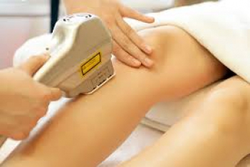 Triệt lông vĩnh viễn bảo hành bao lâu? - Sức khỏe & Môi trường